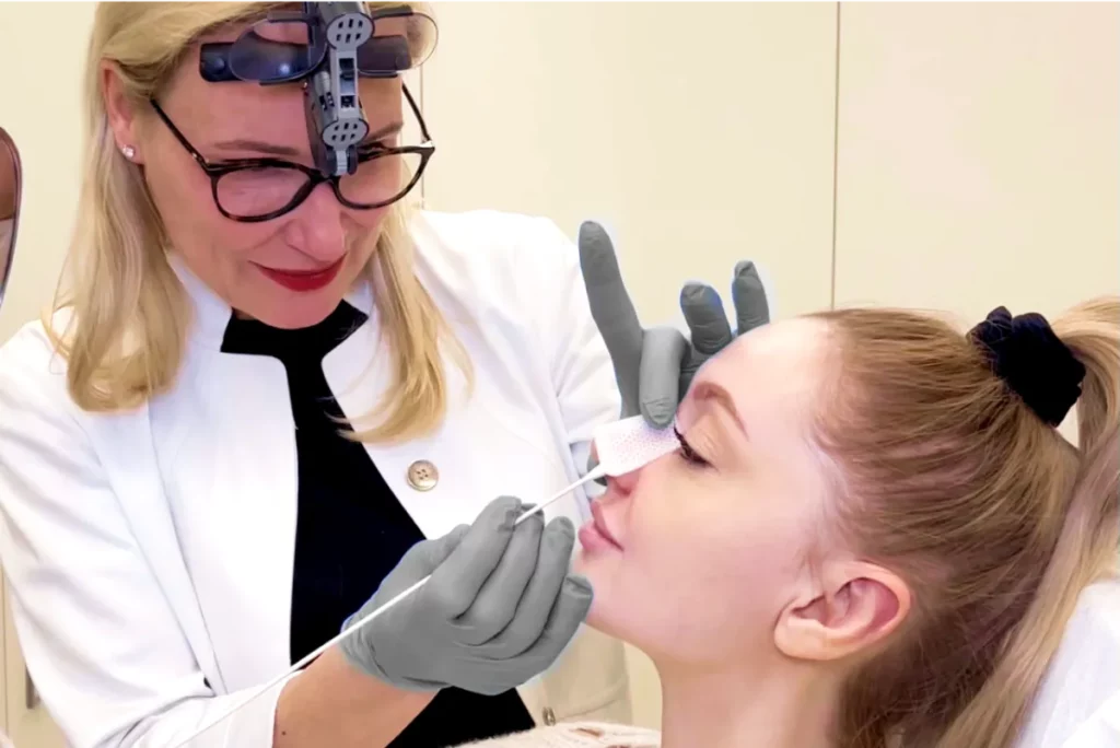 Aufnahme von Dr. Berkei, die die Nachuntersuchung der Nase bei einer Patientin mithilfe eines langen Wattestäbchens durchführt.